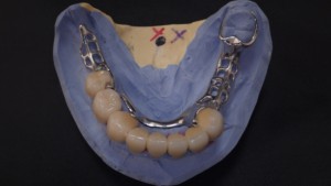 Shaunn’s Dental Lab