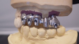 Shaunn’s Dental Lab