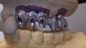 Shaunn’s Dental Lab