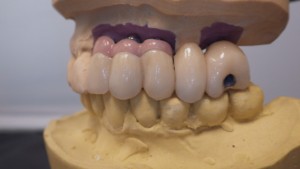 Shaunn’s Dental Lab