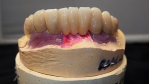 Shaunn’s Dental Lab
