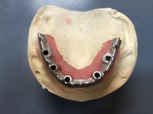 Shaunn’s Dental Lab
