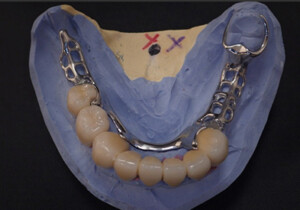 Shaunn’s Dental Lab