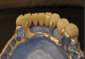 Shaunn’s Dental Lab