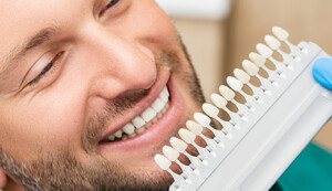 Veneers